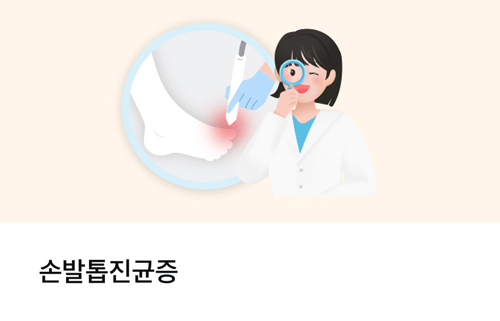 손발톱진균증