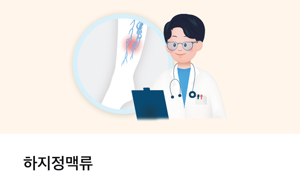하지정맥류