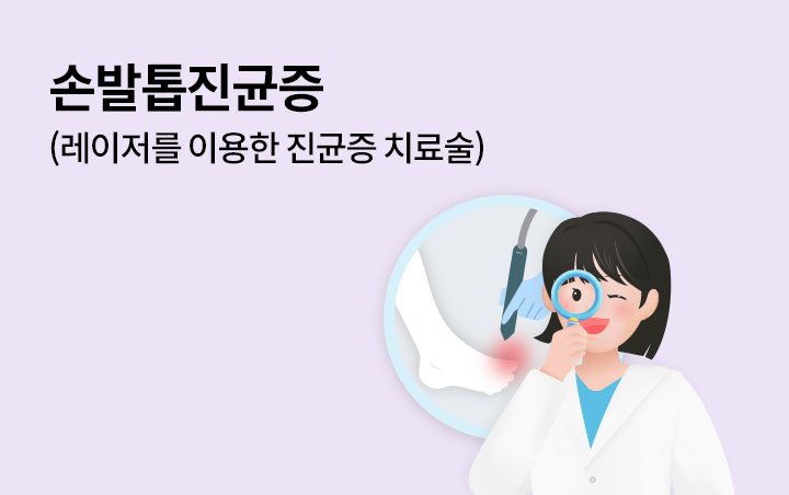 손발톱진균증(레이저를 이용한 진균증 치료술)