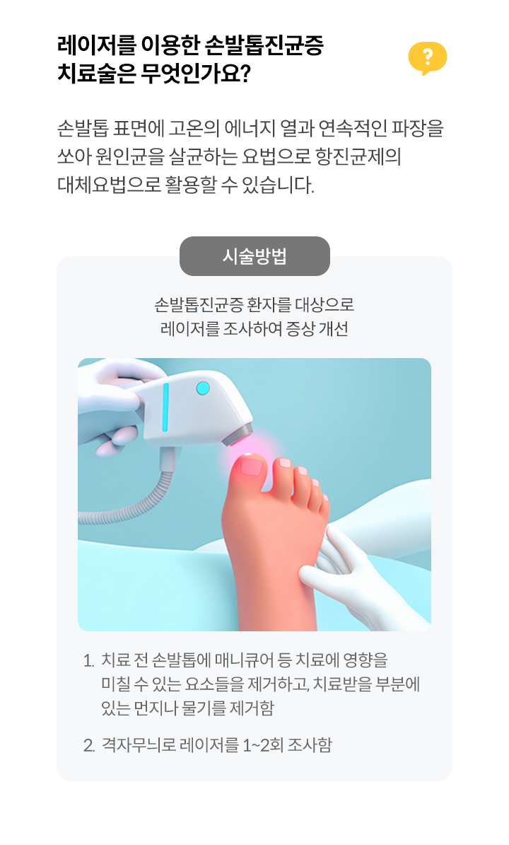 레이저를 이용한 손발톱진균증 치료술은 무엇인가요?
