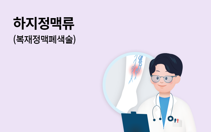 하지정맥류(복재정맥폐색술)